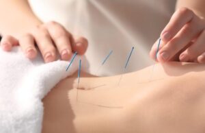 7 NYC Acupuncture Clinics Specializing in Pain Management You Should Know