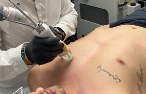 Sensitive Skin Grooming Guide Before Visiting Full Body Hair Removal For Male Near Me Full Body Hair Removal For Male Near Me