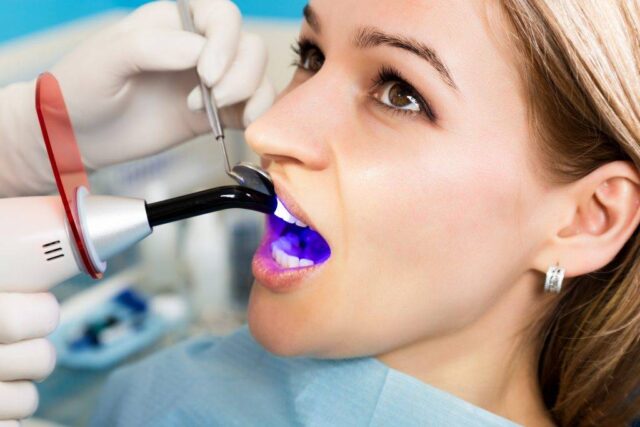 Laser Dental Cleaning