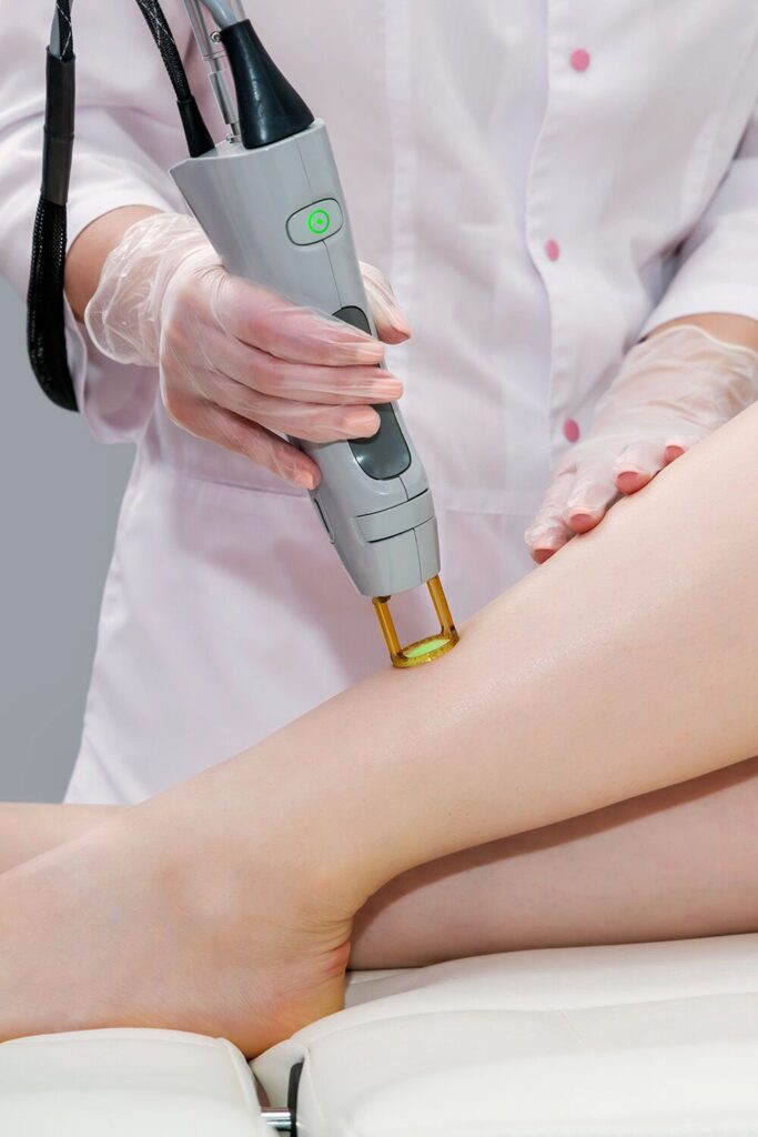Laser Hair Removal in Riyadh