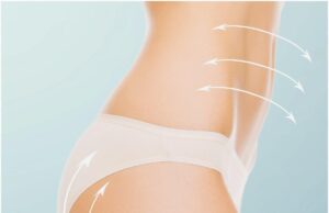 Mastering Liposuction Recovery: Fast Tips for Smooth Healing Liposuction in Riyadh