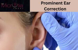 Ear Reshaping in India vs Abroad: What Should You Choose? ear reshaping surgery