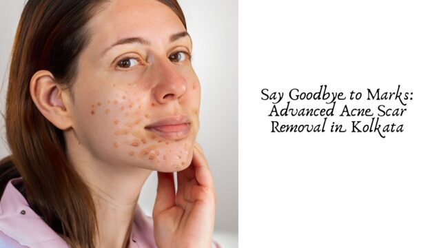 Say Goodbye to Marks: Advanced Acne Scar Removal in Kolkata