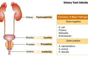 UTI Treatment Munster and Advanced Diagnostic Technology