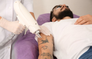 Picosure Laser Tattoo Removal Erase Ink From Complex Tattoo Designs Picosure Tattoo Removal in Dubai