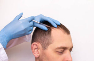 Can GFC Treatment Strengthen Weak Hair Follicles? GFC Treatment For Hair In Dubai