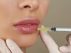 Can Lip Fillers Reduce Visible Lines Around The Lips Area? Lip Fillers in Dubai