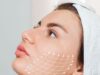 Can Nano Thread Lifts Restore Smoother Skin Appearance? Nano Thread Lifts in Dubai