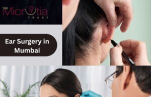 How To Choose The Best Doctor For Ear Reconstruction? ear reconstruction surgery