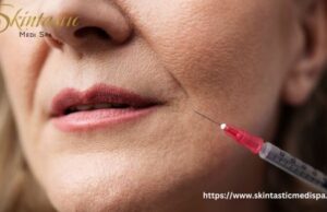 Top Dermal Fillers Riverside for Smooth and Radiant Skin Fillers Riverside