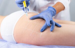 How Do Fat Loss Injections Work on Localized Fat Deposits? Fat Loss Injections Dubai