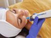 How Does Dermapen Microneedling Improve Skin Elasticity? Dermapen Microneedling in Dubai