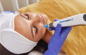 How Does Dermapen Microneedling Improve Skin Elasticity? Dermapen Microneedling in Dubai