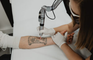 How does laser tattoo removal work for stubborn ink layers? Laser Tattoo Removal Dubai