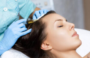 PRP and Hair Loss Prevention Strategies in Riyadh prp hair treatment in riyadh