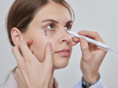 Polynucleotides Under Eyes In Manchester – Rejuvenate Tired Eyes Naturally Polynucleotides Under Eyes In Manchester