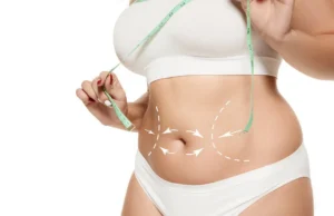 How to Find the Best Tummy Tuck Surgeon in Dubai for Your Needs