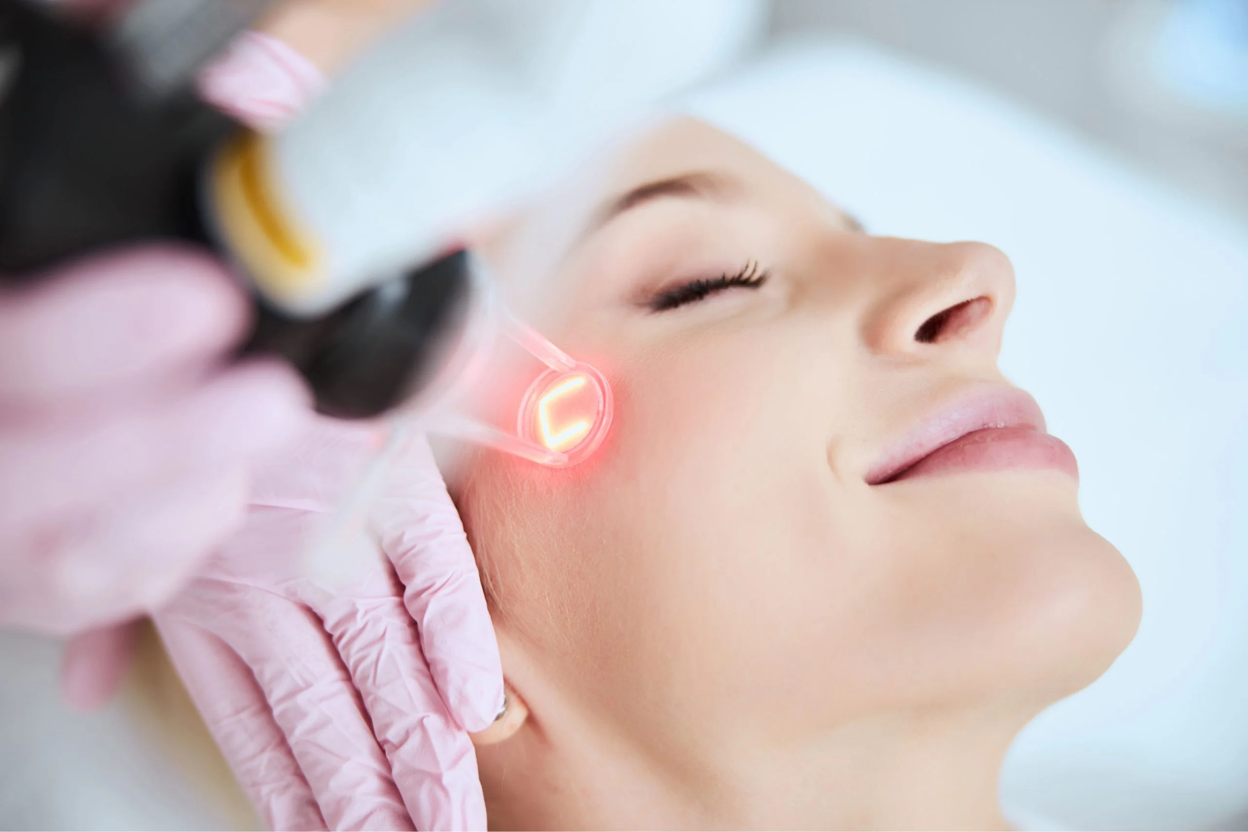 What Is the Ideal Skin Type for Pico Laser Therapy? Pico Laser Treatment in Dubai