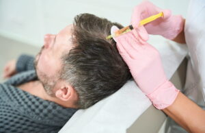 Why PRP Treatment Is Trending in Hair Regrowth? PRP Treatment in Dubai