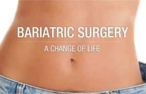 Bariatric Surgery in Islamabad: Procedures, Benefits, and Costs bariatric surgery in Islamabad