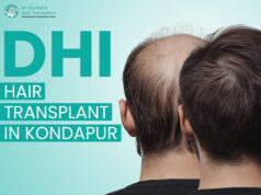What is the Science Behind DHI Hair Transplant? DHI Hair Transplant in Kondapur