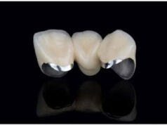 DMLS Technology Explained: Transforming Modern Dental Labs