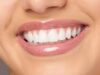 Hollywood Smile in Islamabad: Transform Your Smile with Precision and Perfection Hollywood Smile in Islamabad: Transform Your Smile with Precision and Perfection