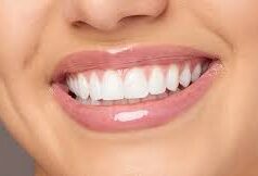 Hollywood Smile in Islamabad: Transform Your Smile with Precision and Perfection Hollywood Smile in Islamabad: Transform Your Smile with Precision and Perfection