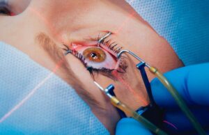 Best Eye Surgeon in Dubai for Cataract and LASIK Care