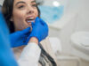 Why Teeth Retainers in Islamabad Are Essential for a Lasting Smile Why Teeth Retainers in Islamabad Are Essential for a Lasting Smile