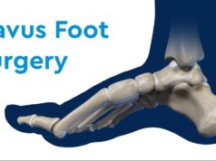 Specialist Surgery for Complex Foot Deformities Edinburgh Specialist Surgery for Complex Foot Deformities Edinburgh