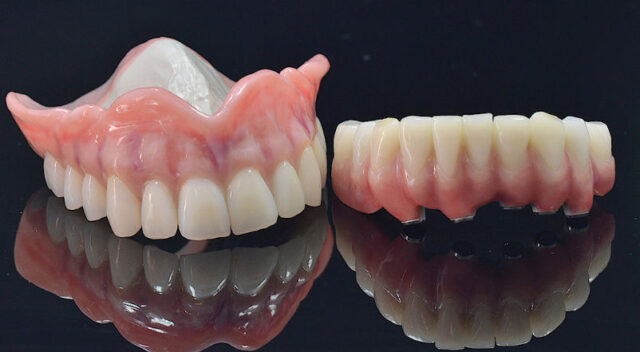 peek dental material